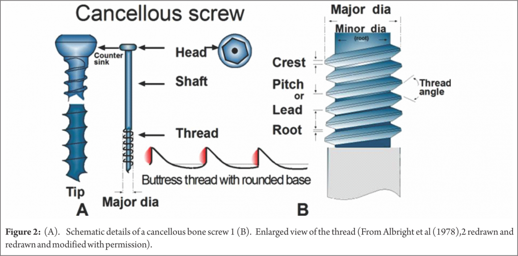 Cancellous screws Archives Trauma International